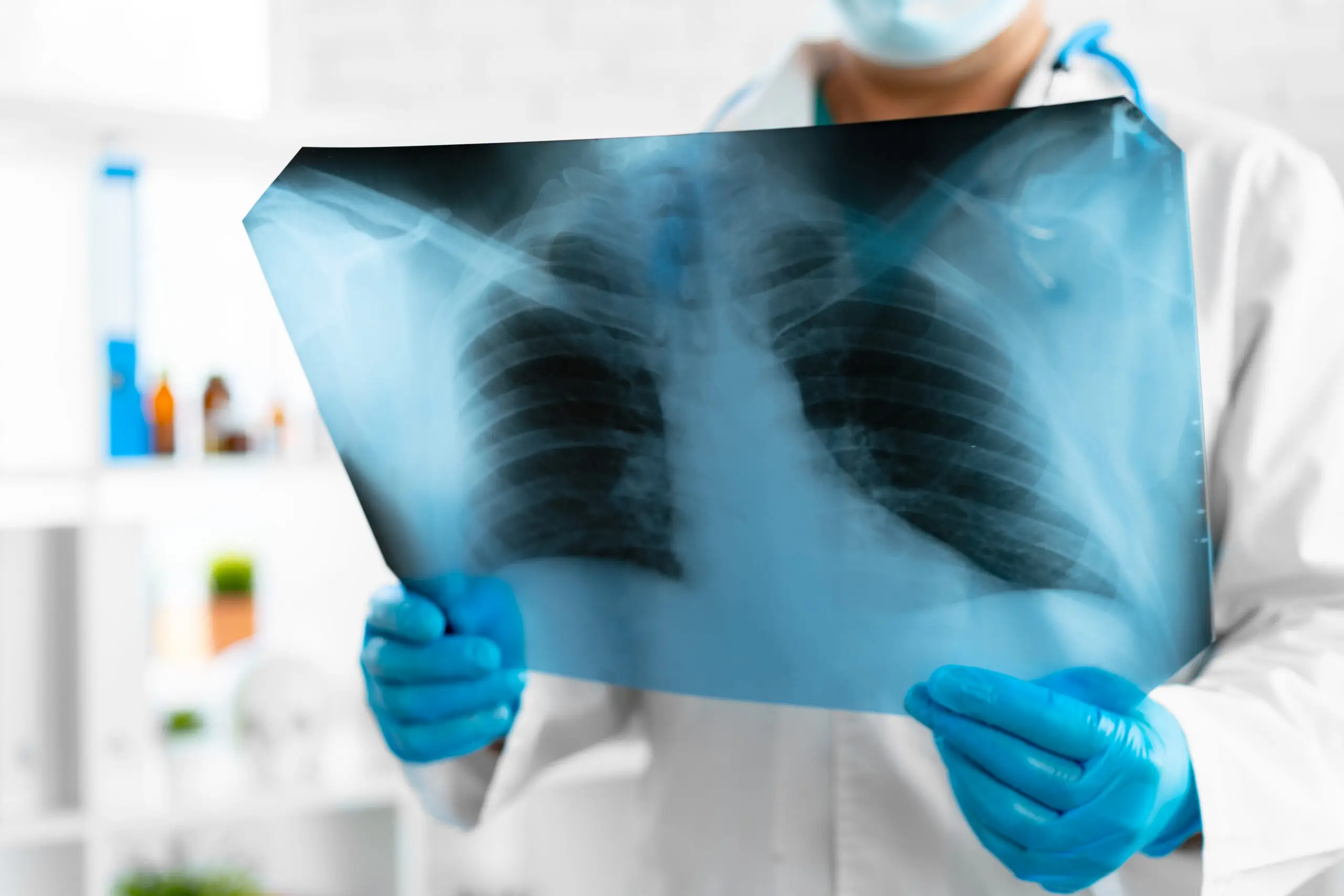 Asbestos Physical Examination