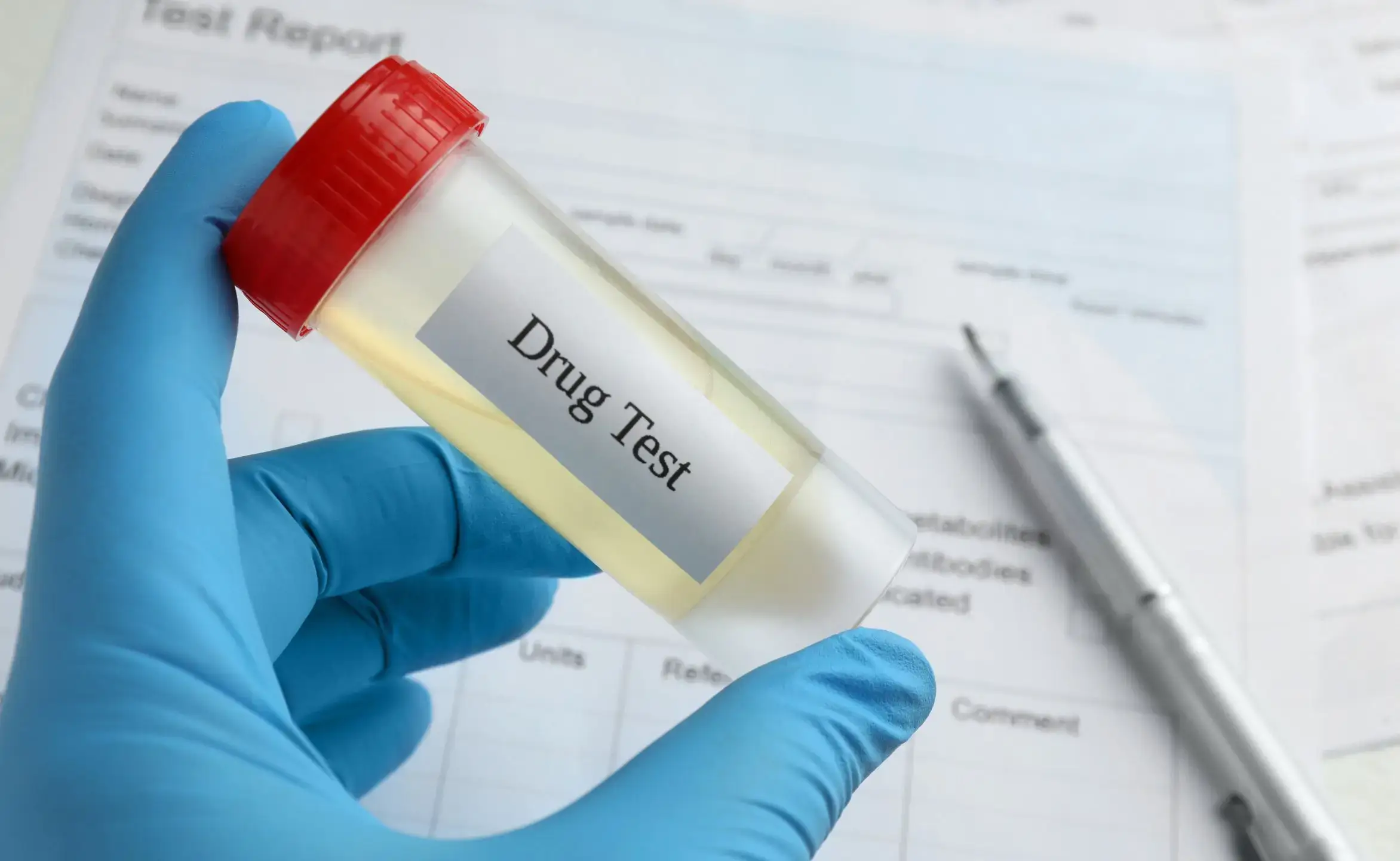 Post Accident Drug Testing Services